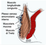 emorroidi e prolasso